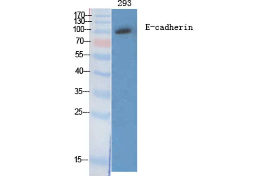 Western blot - E-cadherin Polyclonal Antibody from Signalway Antibody (40860) - Antibodies.com