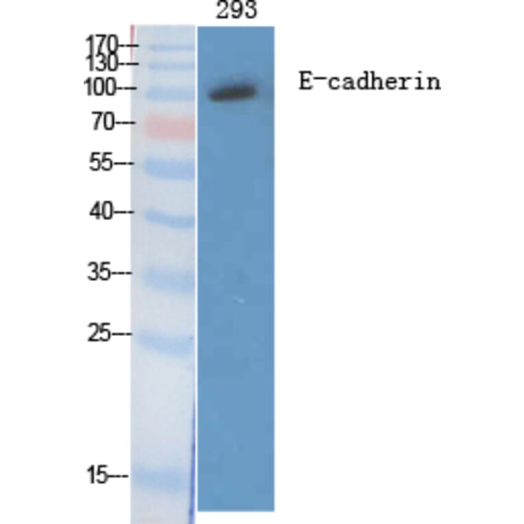 Western blot - E-cadherin Polyclonal Antibody from Signalway Antibody (40860) - Antibodies.com