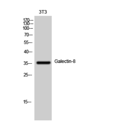 Western blot - Galectin-8 Polyclonal Antibody from Signalway Antibody (40946) - Antibodies.com