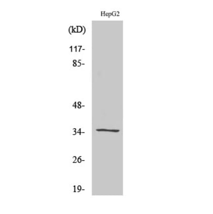 Western blot - Galectin-9 Polyclonal Antibody from Signalway Antibody (40947) - Antibodies.com