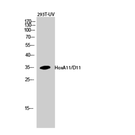 Western blot - HoxA11/D11 Polyclonal Antibody from Signalway Antibody (41028) - Antibodies.com