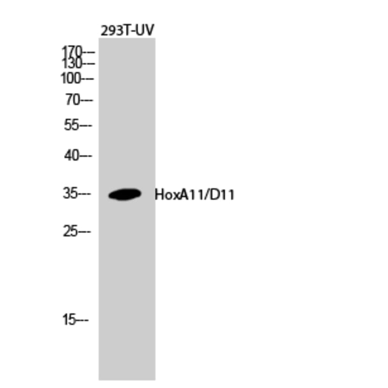 Western blot - HoxA11/D11 Polyclonal Antibody from Signalway Antibody (41028) - Antibodies.com