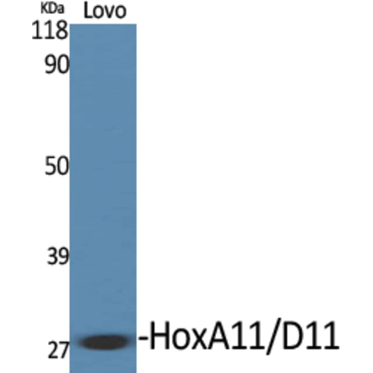 Western blot - HoxA11/D11 Polyclonal Antibody from Signalway Antibody (41028) - Antibodies.com