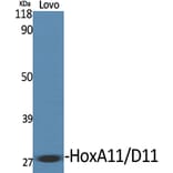 Western blot - HoxA11/D11 Polyclonal Antibody from Signalway Antibody (41028) - Antibodies.com