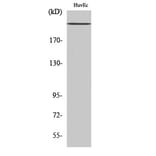 Western blot - Na+ CP-pan Polyclonal Antibody from Signalway Antibody (41201) - Antibodies.com
