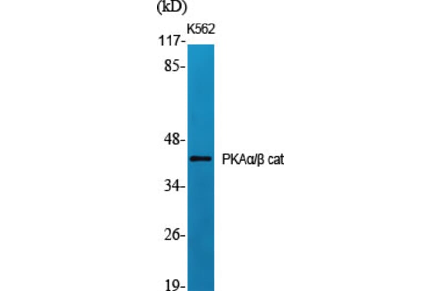 Western blot - PKAα/β cat Polyclonal Antibody from Signalway Antibody (41345) - Antibodies.com