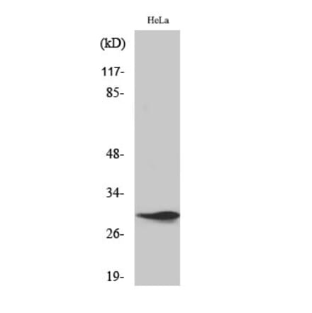 Western blot - Spindlin-1 Polyclonal Antibody from Signalway Antibody (41455) - Antibodies.com