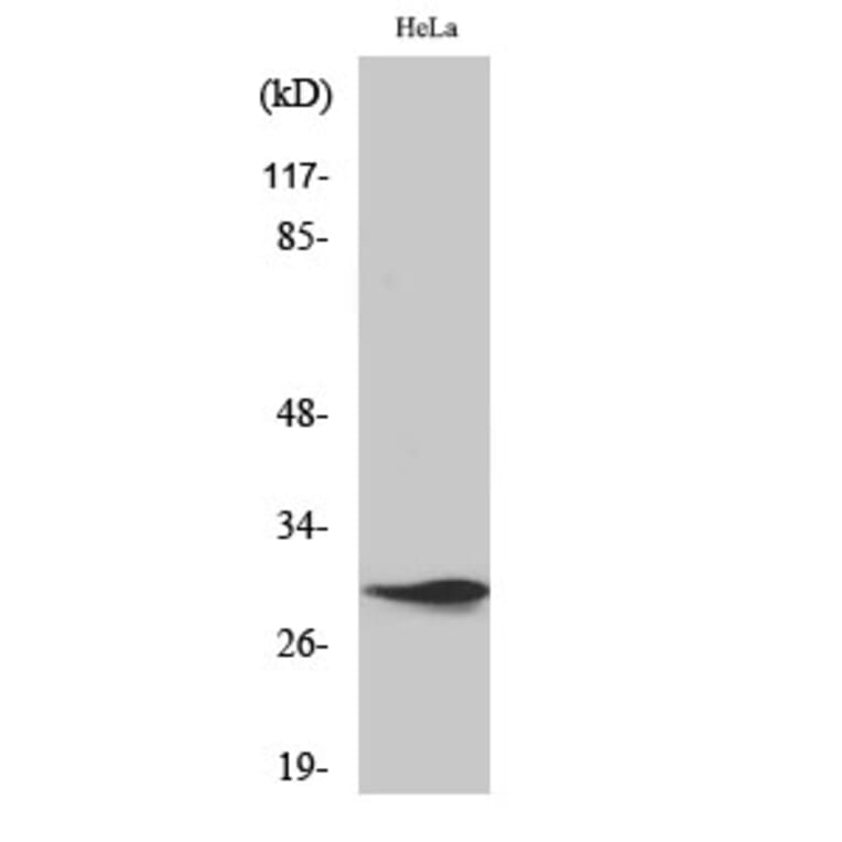 Western blot - Spindlin-1 Polyclonal Antibody from Signalway Antibody (41455) - Antibodies.com