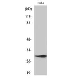 Western blot - Spindlin-1 Polyclonal Antibody from Signalway Antibody (41455) - Antibodies.com