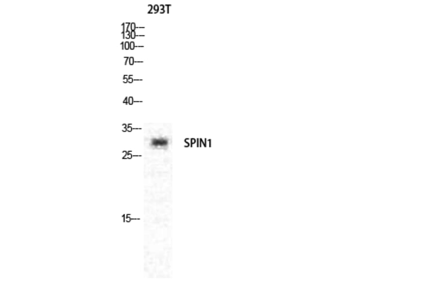Western blot - Spindlin-1 Polyclonal Antibody from Signalway Antibody (41455) - Antibodies.com