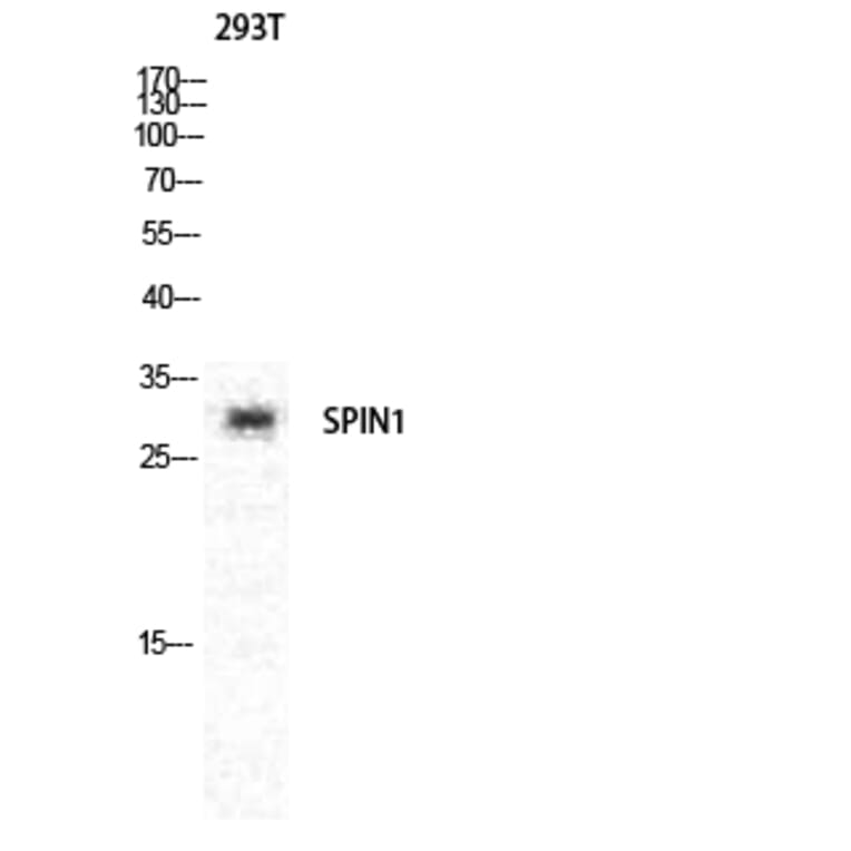 Western blot - Spindlin-1 Polyclonal Antibody from Signalway Antibody (41455) - Antibodies.com