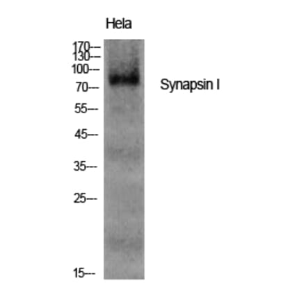 Western blot - Synapsin I Polyclonal Antibody from Signalway Antibody (41470) - Antibodies.com