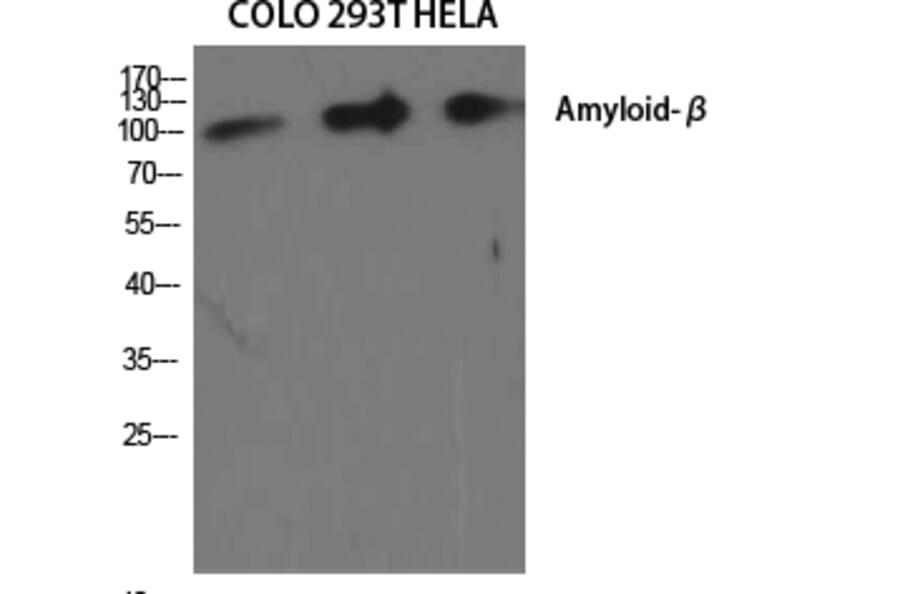 Western blot - Amyloid-β Polyclonal Antibody from Signalway Antibody (40587) - Antibodies.com