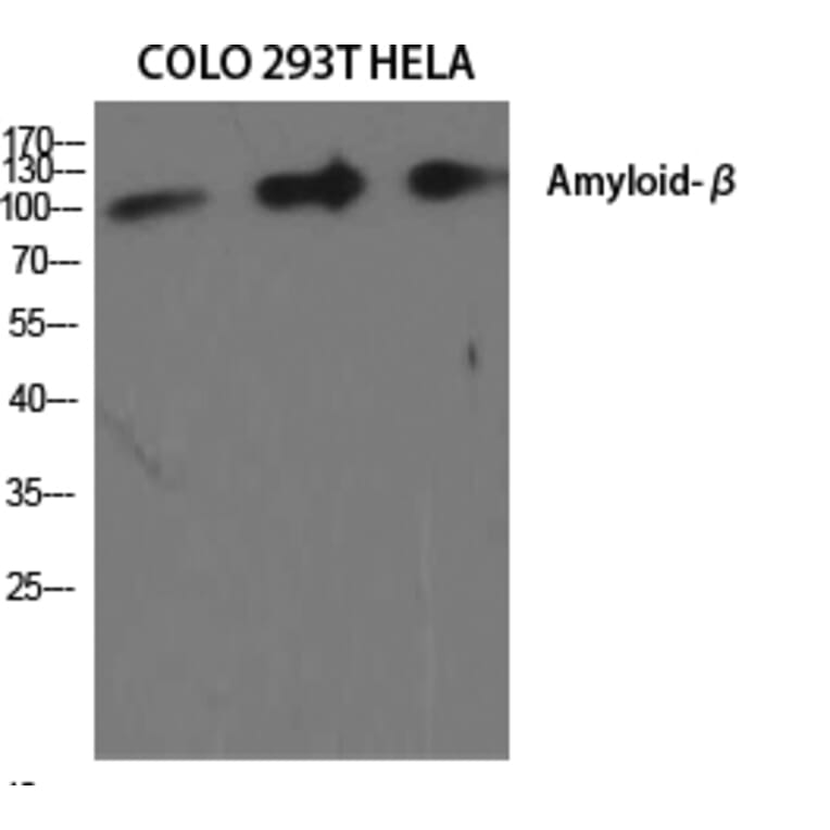 Western blot - Amyloid-β Polyclonal Antibody from Signalway Antibody (40587) - Antibodies.com