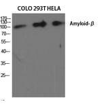 Western blot - Amyloid-β Polyclonal Antibody from Signalway Antibody (40587) - Antibodies.com