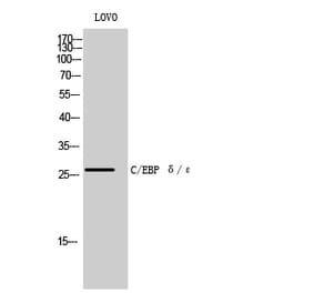 Western blot - C/EBP δ/ε Polyclonal Antibody from Signalway Antibody (40659) - Antibodies.com