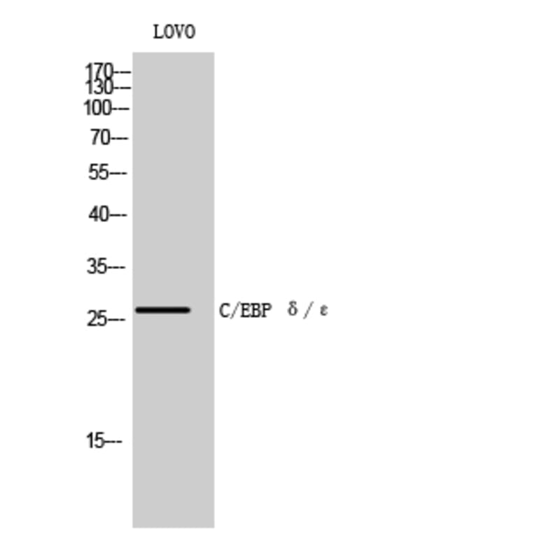 Western blot - C/EBP δ/ε Polyclonal Antibody from Signalway Antibody (40659) - Antibodies.com