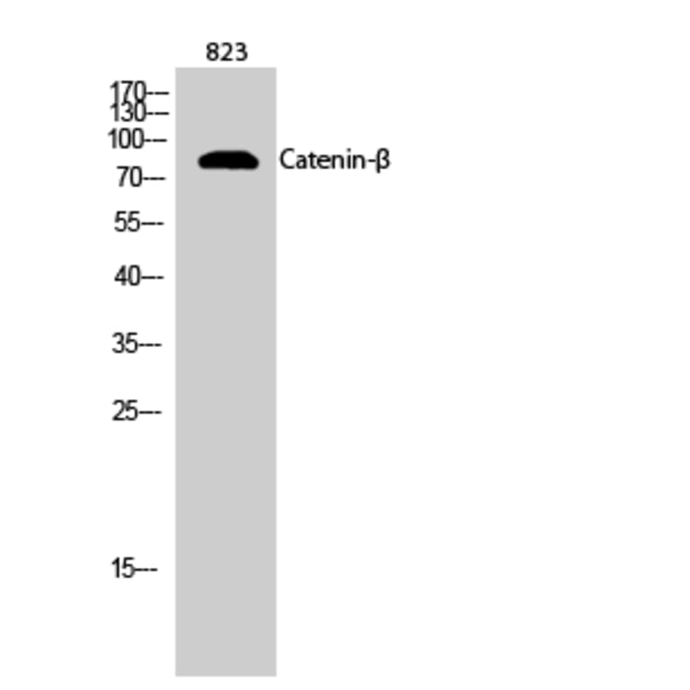 Western blot - Catenin-β Polyclonal Antibody from Signalway Antibody (40679) - Antibodies.com