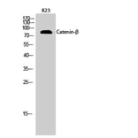 Western blot - Catenin-β Polyclonal Antibody from Signalway Antibody (40679) - Antibodies.com