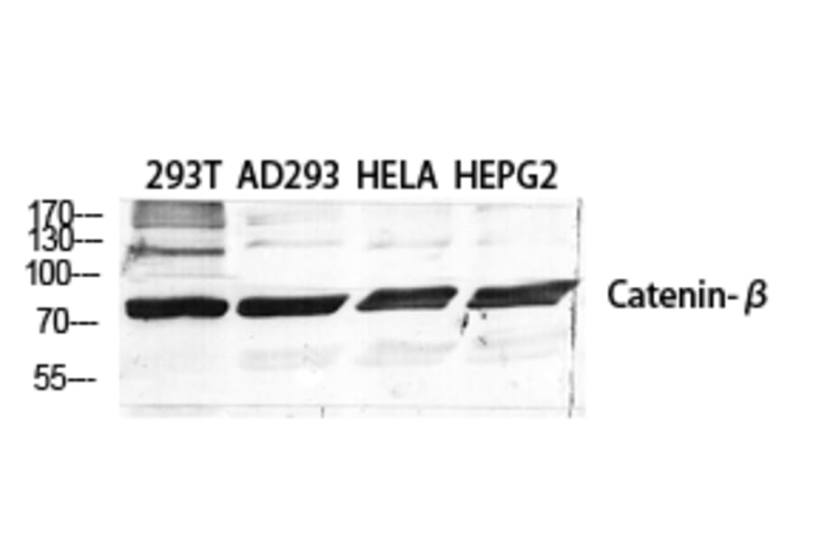 Western blot - Catenin-β Polyclonal Antibody from Signalway Antibody (40679) - Antibodies.com