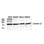 Western blot - Catenin-β Polyclonal Antibody from Signalway Antibody (40679) - Antibodies.com