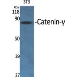 Western blot - Catenin-γ Polyclonal Antibody from Signalway Antibody (40683) - Antibodies.com