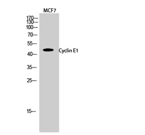 Western blot - Cyclin E1 Polyclonal Antibody from Signalway Antibody (40804) - Antibodies.com