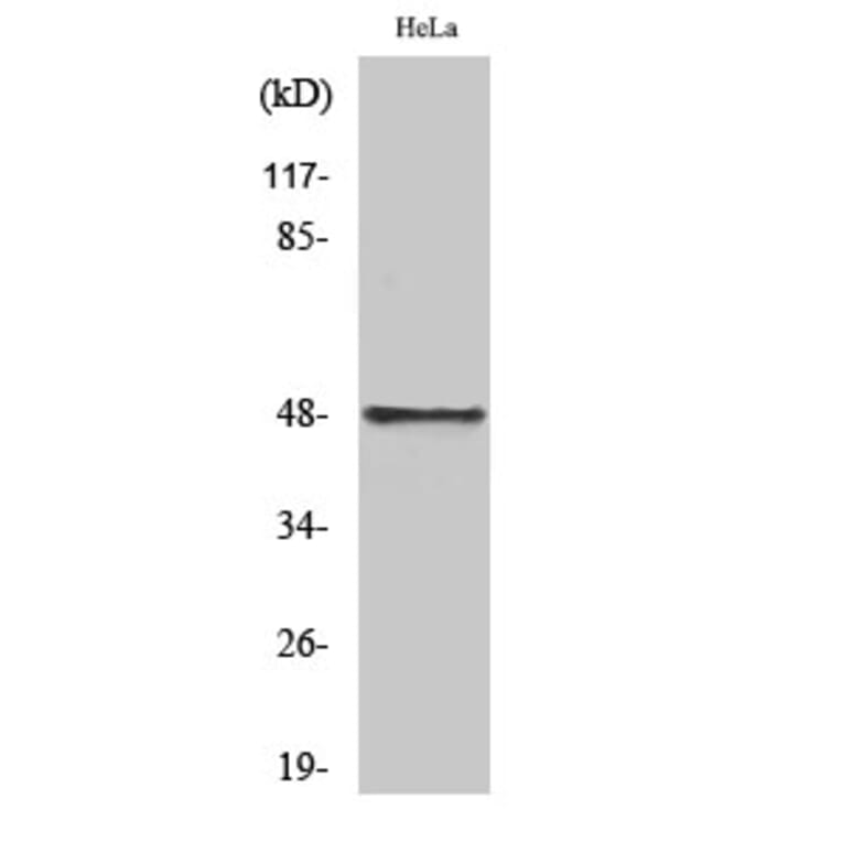 Western blot - Cyclin E1 Polyclonal Antibody from Signalway Antibody (40805) - Antibodies.com
