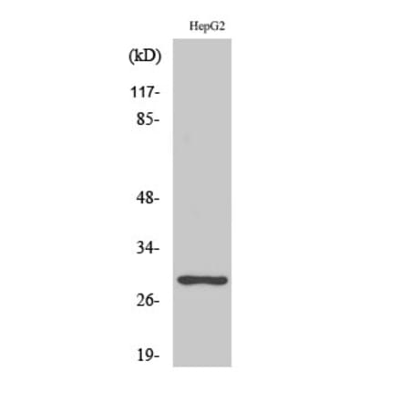 Western blot - PTTG1/2/3 Polyclonal Antibody from Signalway Antibody (41371) - Antibodies.com