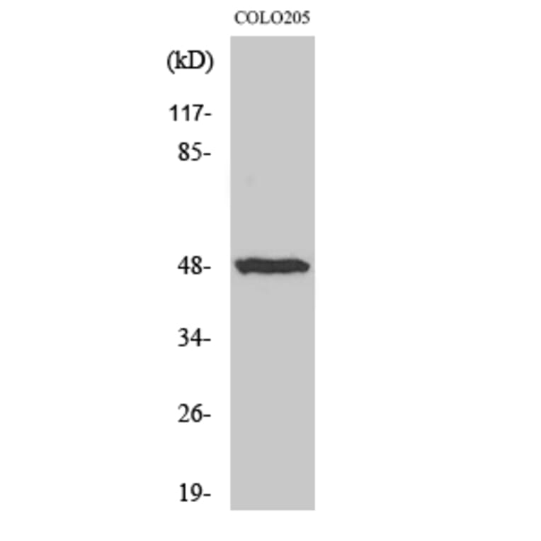 Western blot - IL-13Rα1 Polyclonal Antibody from Signalway Antibody (41058) - Antibodies.com