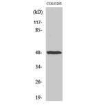Western blot - IL-13Rα1 Polyclonal Antibody from Signalway Antibody (41058) - Antibodies.com