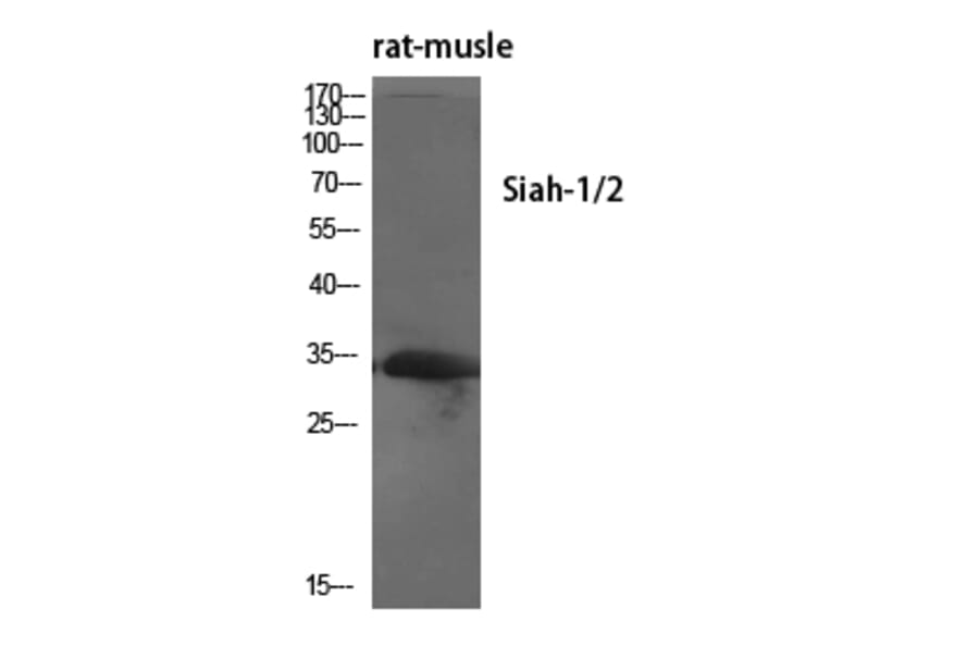 Western blot - Siah-1/2 Polyclonal Antibody from Signalway Antibody (41434) - Antibodies.com