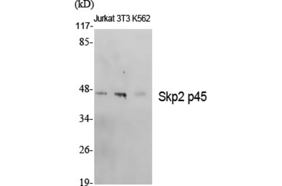 Western blot - Skp2 p45 Polyclonal Antibody from Signalway Antibody (41438) - Antibodies.com