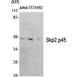 Western blot - Skp2 p45 Polyclonal Antibody from Signalway Antibody (41438) - Antibodies.com