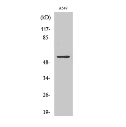 Western blot - Vimentin Polyclonal Antibody from Signalway Antibody (41532) - Antibodies.com