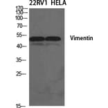 Western blot - Vimentin Polyclonal Antibody from Signalway Antibody (41532) - Antibodies.com
