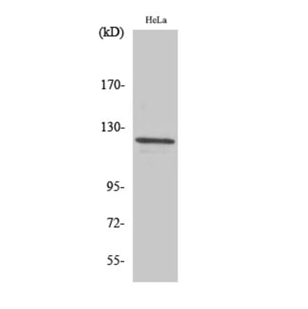 Western blot - Vinculin Polyclonal Antibody from Signalway Antibody (41534) - Antibodies.com