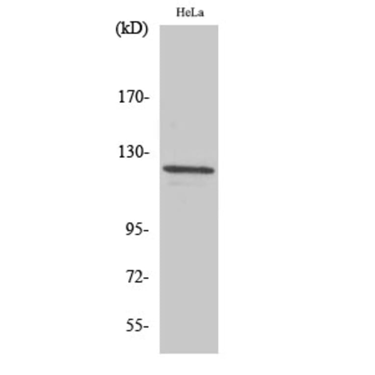 Western blot - Vinculin Polyclonal Antibody from Signalway Antibody (41534) - Antibodies.com