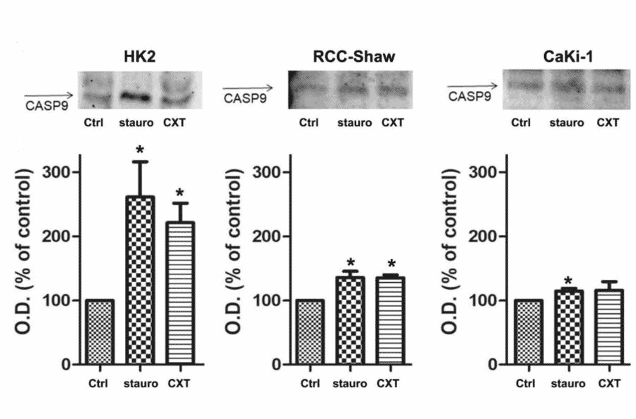 Western Blot - Anti-Cleaved-Caspase-9 p35 (D315) Antibody - Antibodies.com