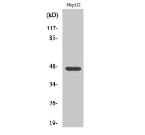 Western blot - AKAP 79 Polyclonal Antibody from Signalway Antibody (40563) - Antibodies.com