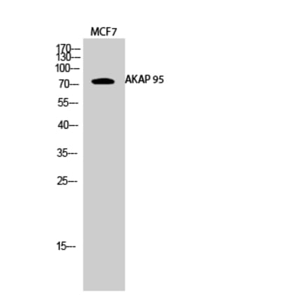 Western blot - AKAP 95 Polyclonal Antibody from Signalway Antibody (40564) - Antibodies.com