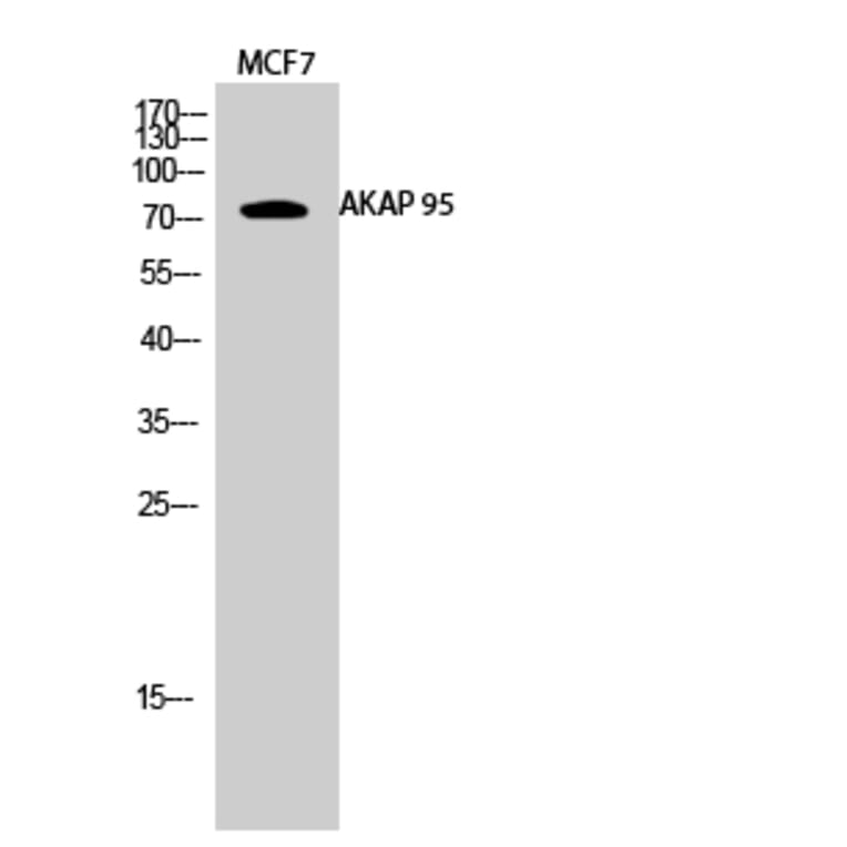 Western blot - AKAP 95 Polyclonal Antibody from Signalway Antibody (40564) - Antibodies.com