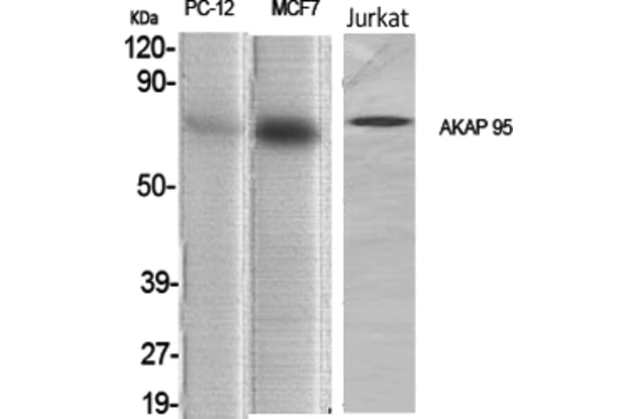 Western blot - AKAP 95 Polyclonal Antibody from Signalway Antibody (40564) - Antibodies.com