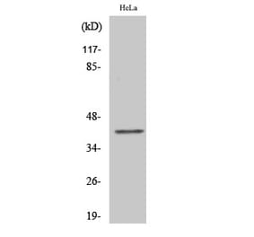 Western blot - ChemR23 Polyclonal Antibody from Signalway Antibody (40737) - Antibodies.com