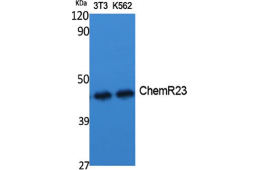 Western blot - ChemR23 Polyclonal Antibody from Signalway Antibody (40737) - Antibodies.com