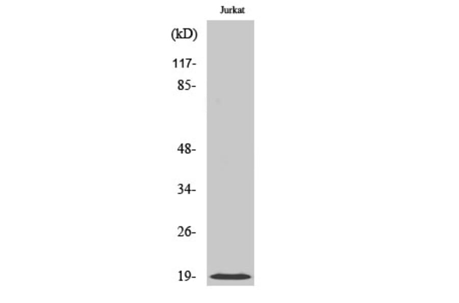 Western blot - Cofilin Polyclonal Antibody from Signalway Antibody (40769) - Antibodies.com