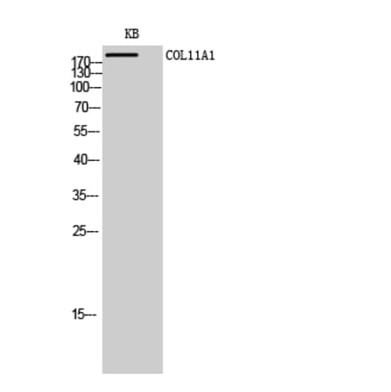 Western blot - COL11A1 Polyclonal Antibody from Signalway Antibody (40770) - Antibodies.com