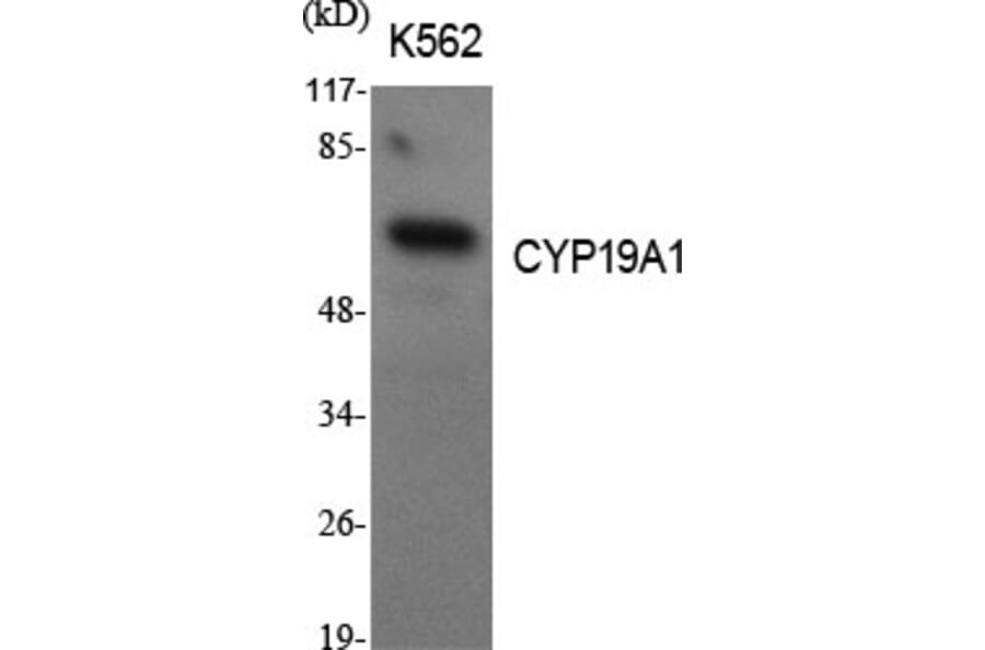 Western blot - CYP19A1 Polyclonal Antibody from Signalway Antibody (40809) - Antibodies.com