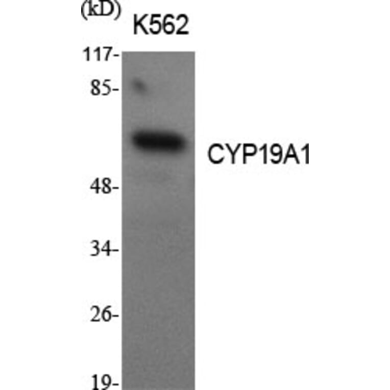 Western blot - CYP19A1 Polyclonal Antibody from Signalway Antibody (40809) - Antibodies.com