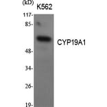 Western blot - CYP19A1 Polyclonal Antibody from Signalway Antibody (40809) - Antibodies.com